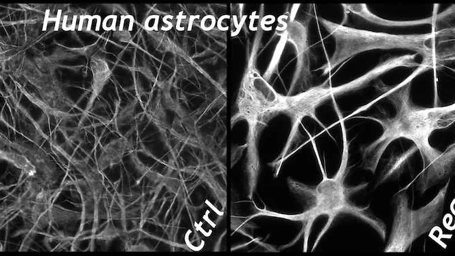 Figure9-human-notext-sf-ann-flat
