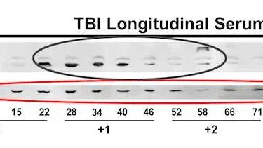PatientM-serum-7-GFAP-ALDO-Control-flat-s-ellipses-120