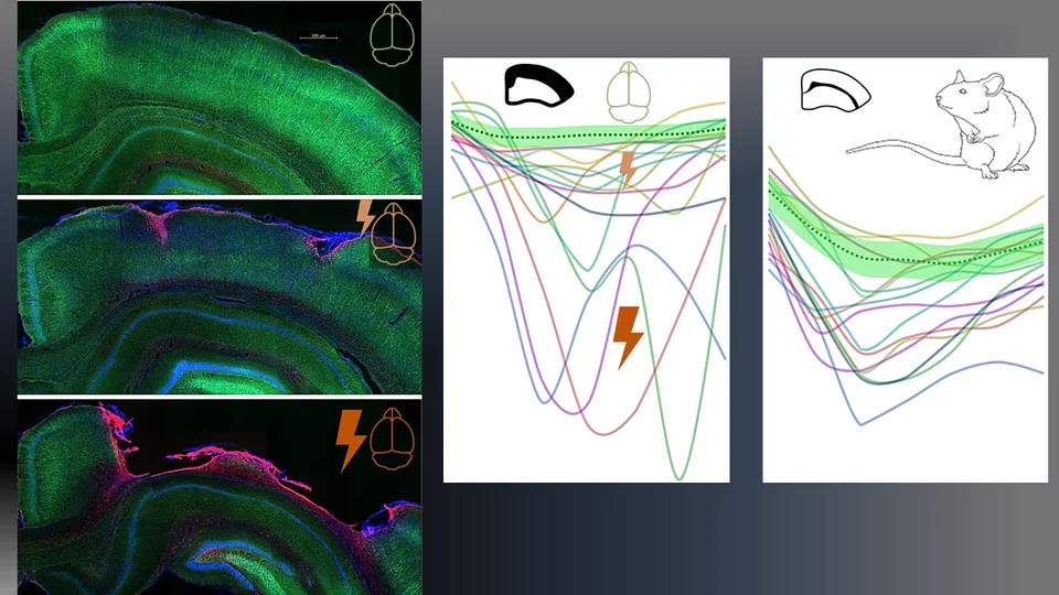 Graphic of ray showing moderate to severe traces
