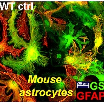 WT-unstretched_sites-front-flat2-revised