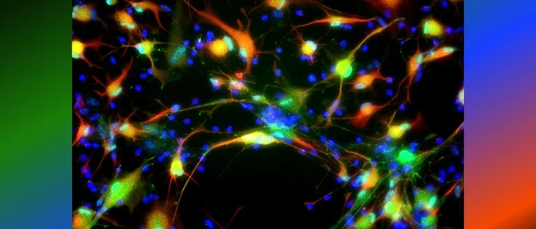 Human astrocytes with two or multiple processes.