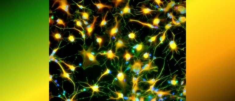 Star-shaped human astrocytes.