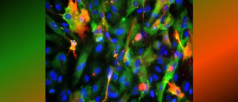 Flat human astrocytes.