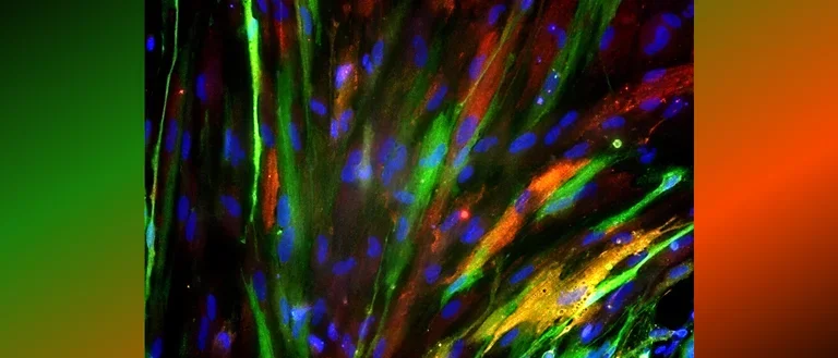 Fibrous human astrocytes.