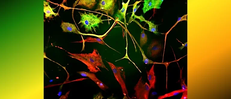 Diverse morphotypes of human astrocytes.
