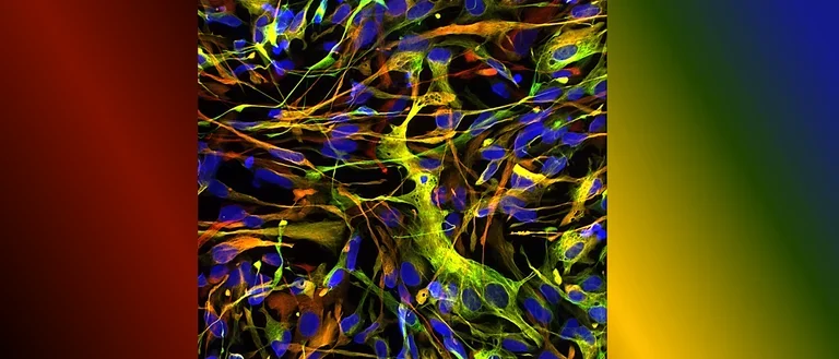 Astrocytes.