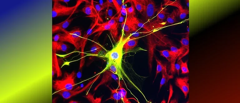 Human cultured star shaped astrocyte.
