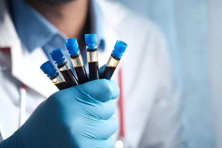 A healthcare professional wearing a blue glove holds five vials from a blood draw.