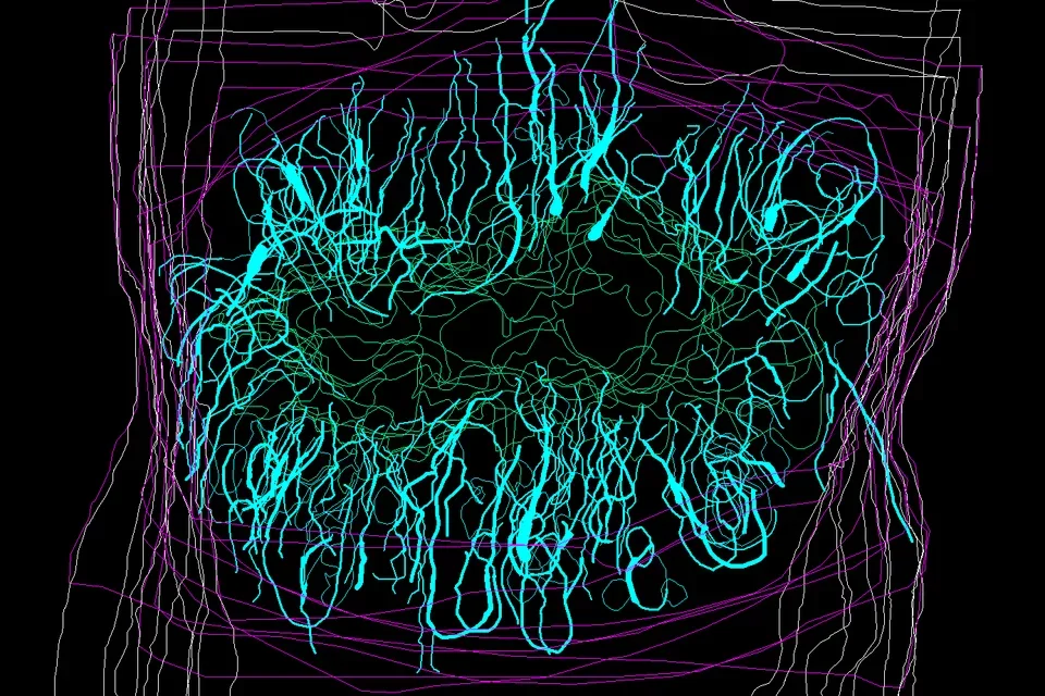 Spinal cord injury astrocytes (tiel) assembly to form the glial scar