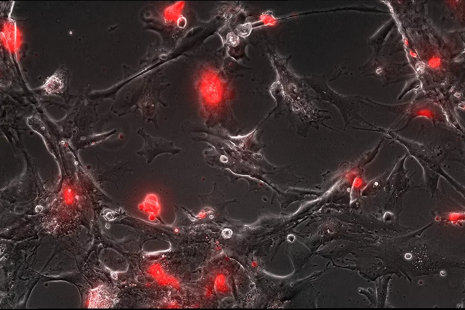 Wounded astrocyte.