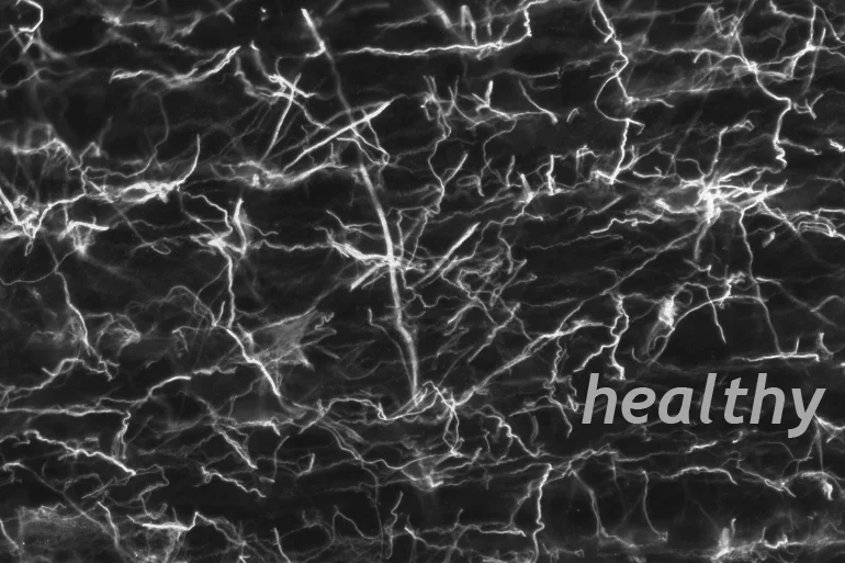 pig51-cr-outer-02l-Crop1-healthy