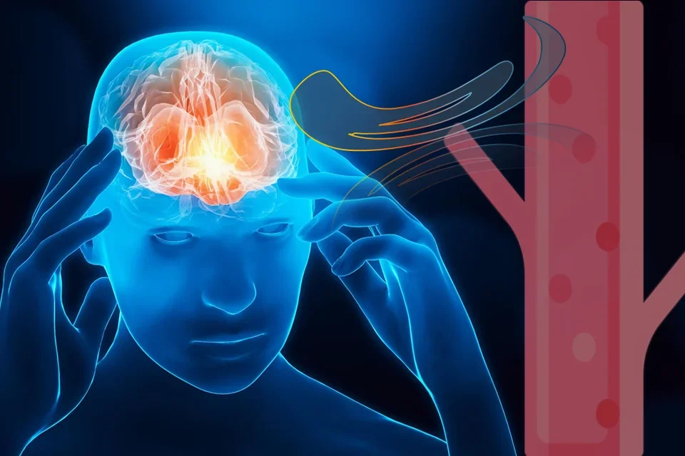 Signatures of brain injury.