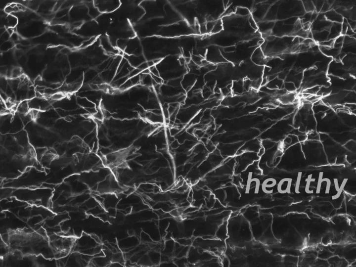 pig51-cr-outer-02l-Crop1-healthy