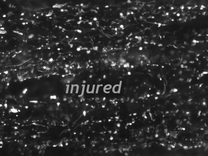 pig53-GFAP-b'-cr-near-01-Crop1-injured