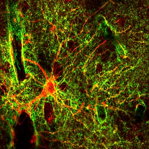 A human astrocyte of the gray matter neocortex.