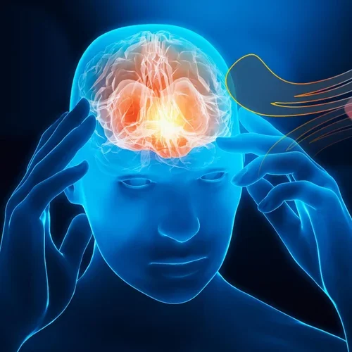 Signatures of brain injury.