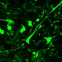 Astrocyte damage, green dye.
