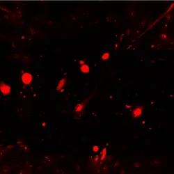 Astrocyte damage, red.