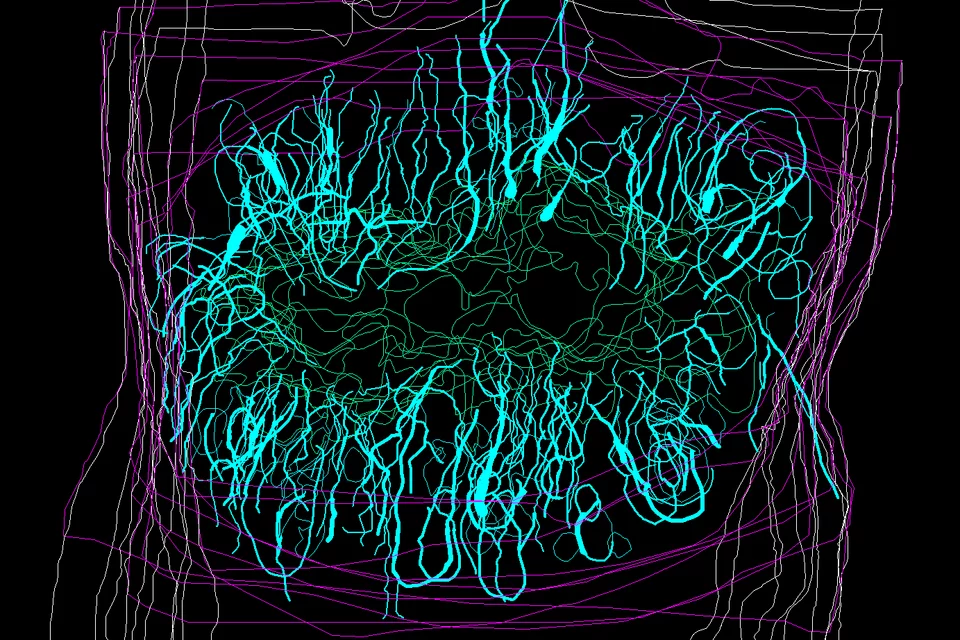 Spinal cord injury astrocytes (tiel) assembly to form the glial scar